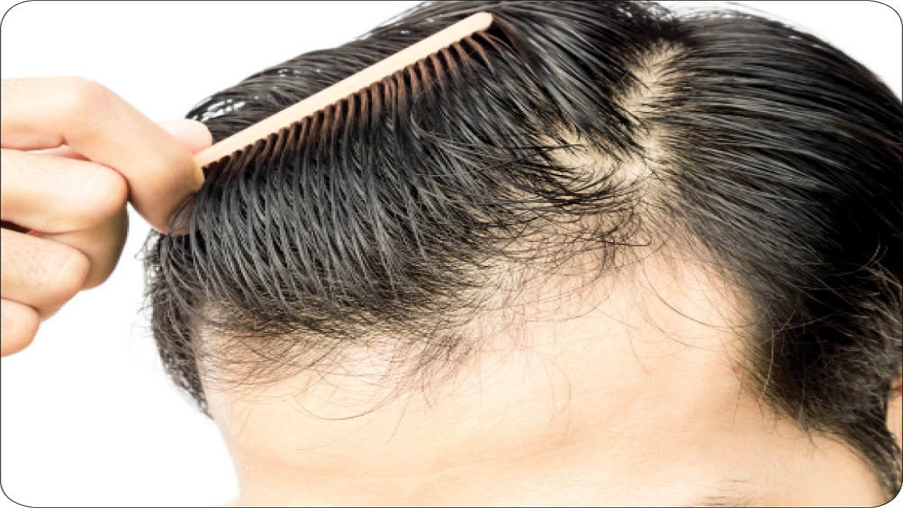 ۴ راه بررسی سلامت مو / برای جلوگیری از ریزش مو چه کنیم؟