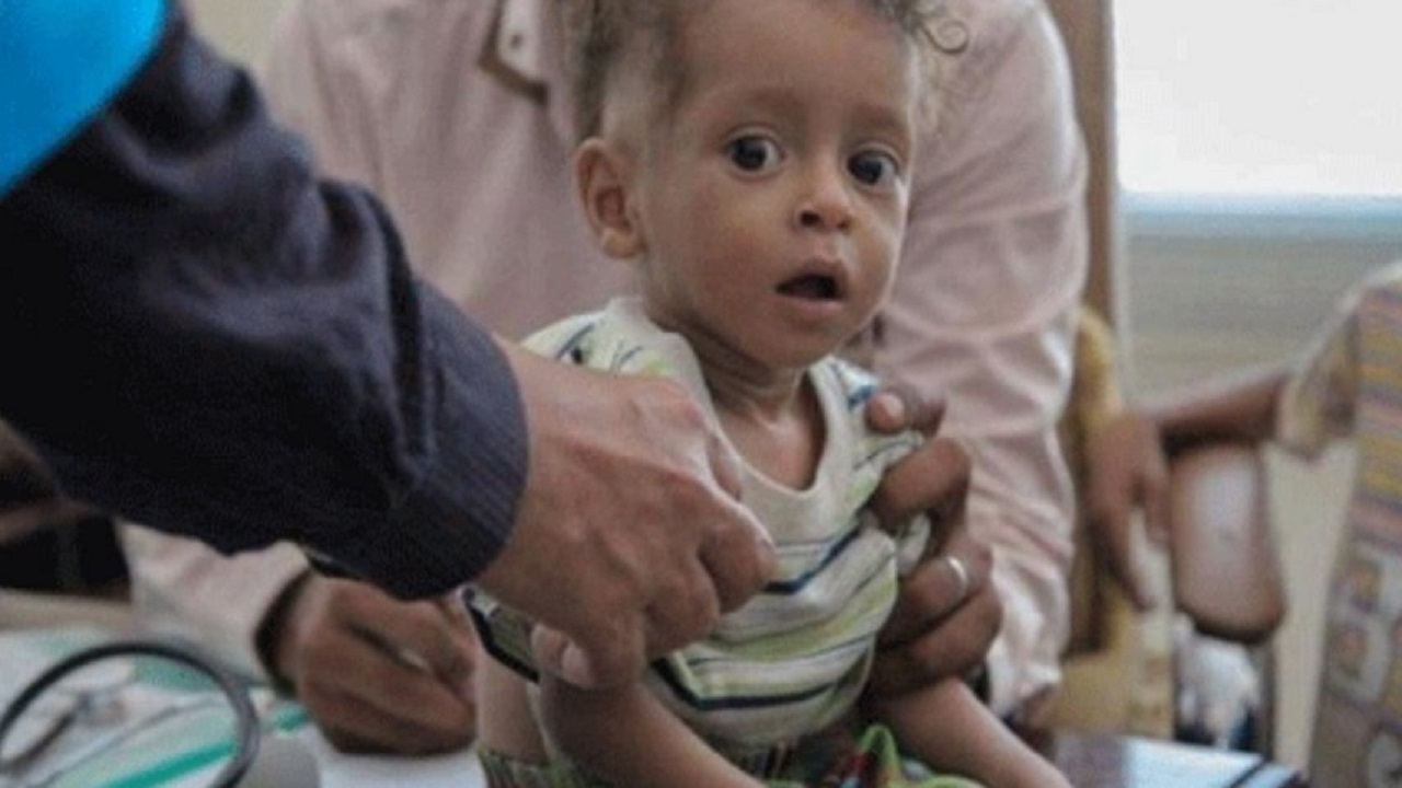 سازمان ملل و آل‌‌سعود دست در دست هم علیه مردم یمن