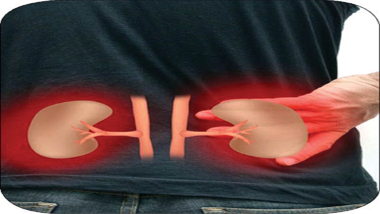 چگونه تفاوت کلیه‌درد با کمردرد را بفهمیم؟