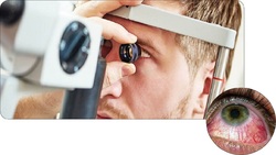 نقش تغذیه در سلامت چشم + فیلم