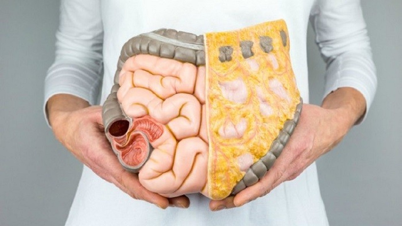 مشکلات گوارشی