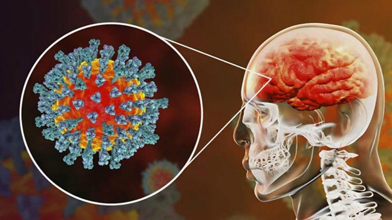ارتباط کرونا باسیستم عصبی بدن/ چگونه کووید ۱۹ باعث سکته می‌شود؟