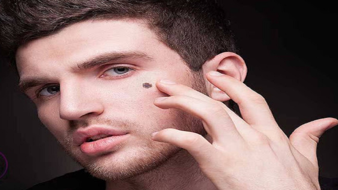 خال صورت شما از شخصیت‌تان چه می گوید؟