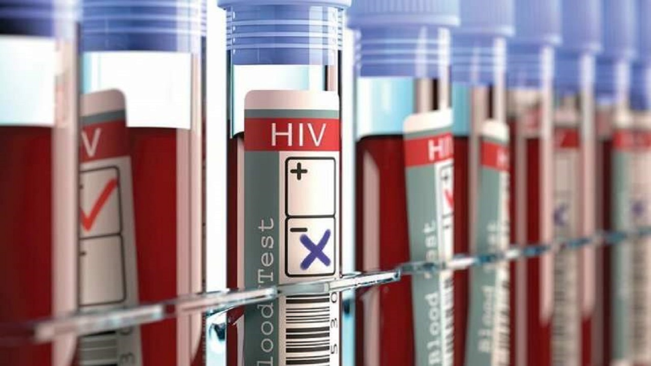 "کرونا" خطری جدی برای مبتلایان به HIV