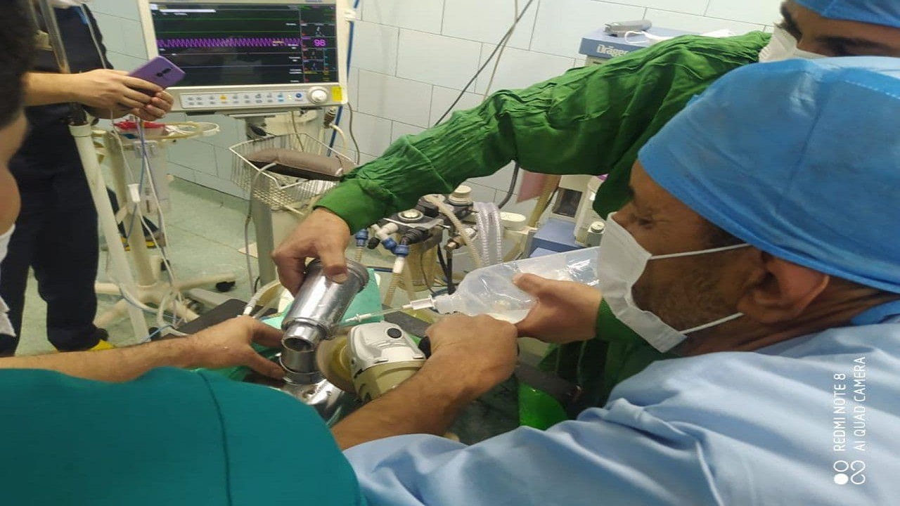 دختر بچه جوانرودی یک دست شد