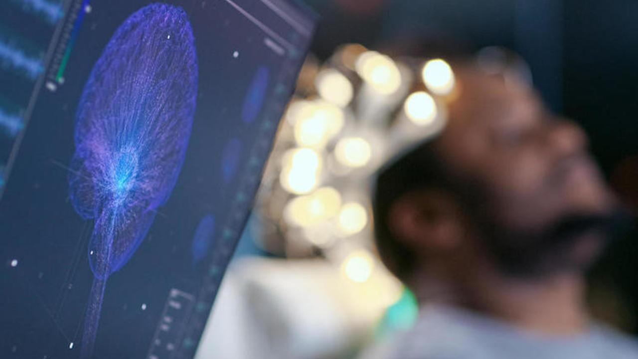 ساخت کلاه ایمنی هوشمند برای پیشگیری از تشنج