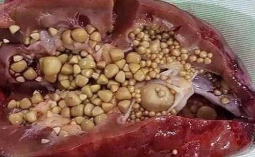 چگونه کمر درد و کلیه درد را از یکدیگر تشخیص دهیم؟