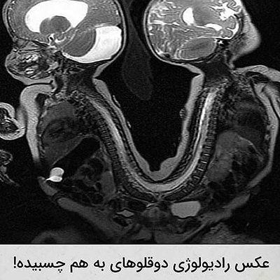 عکس&zwnj;هایی که تابه&zwnj;حال ندیده&zwnj;اید!