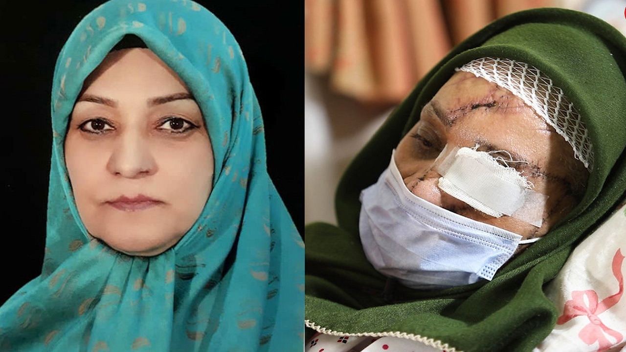 ترسناک&zwnj;ترین سرنوشت یک زن ایرانی / اشرف سادات حسینی تکه تکه شد، اما زنده ماند + (تصاویر ۱۶+)