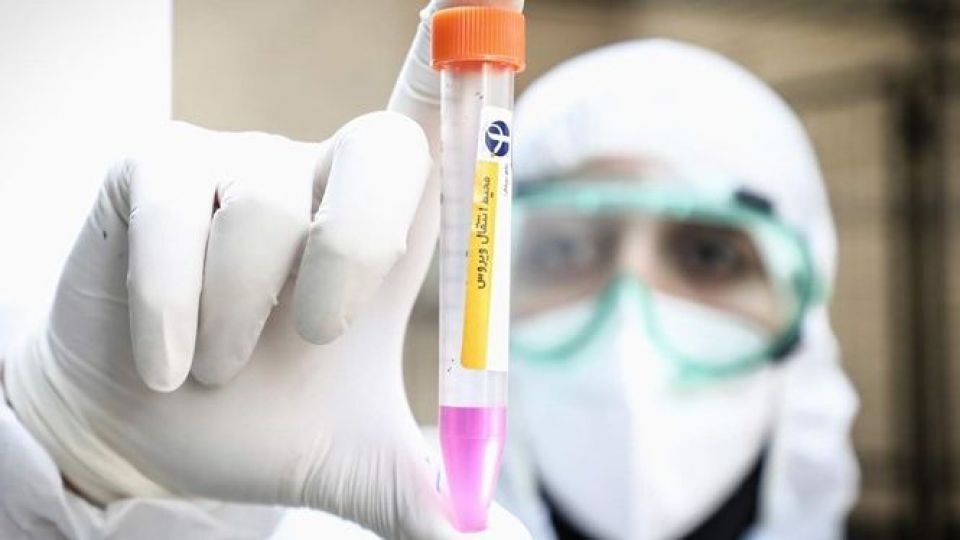 تست pcr