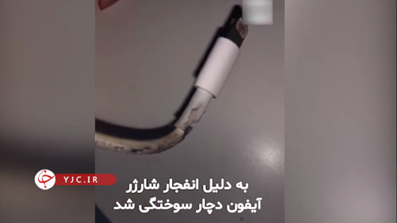 پیگیری شرکت اپل بعد از انفجار شارژر آیفون در صورت یک دختر