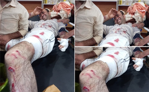 حمله پلنگ به مردی ۳۶ ساله در ارتفاعات بخش پاتاوه