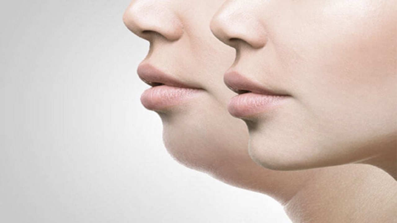 راهکار‌های طلایی برای رهایی از غبغب