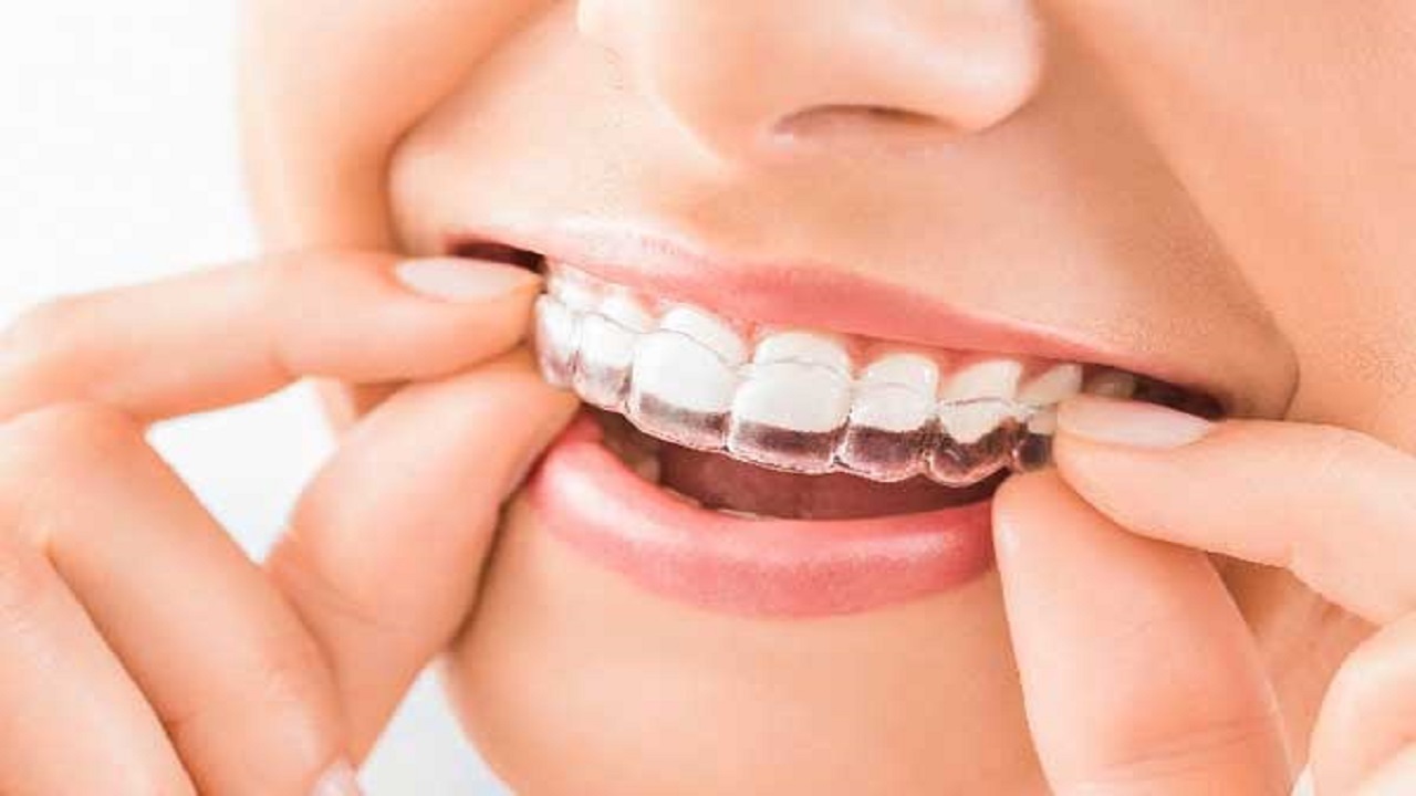 سن طلایی برای ارتودنسی /چگونه بفهمیم به ارتودنسی نیاز داریم؟