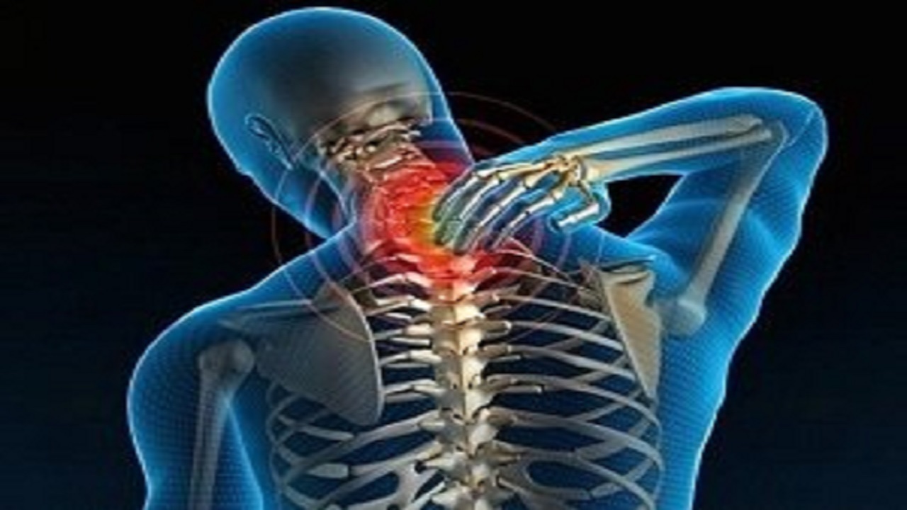 درمان انحراف های عضلانی بدن بدون جراحی