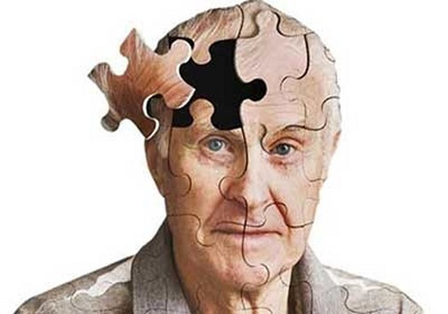 چه کنیم و چه بخوریم تا آلزایمر نگیریم؟