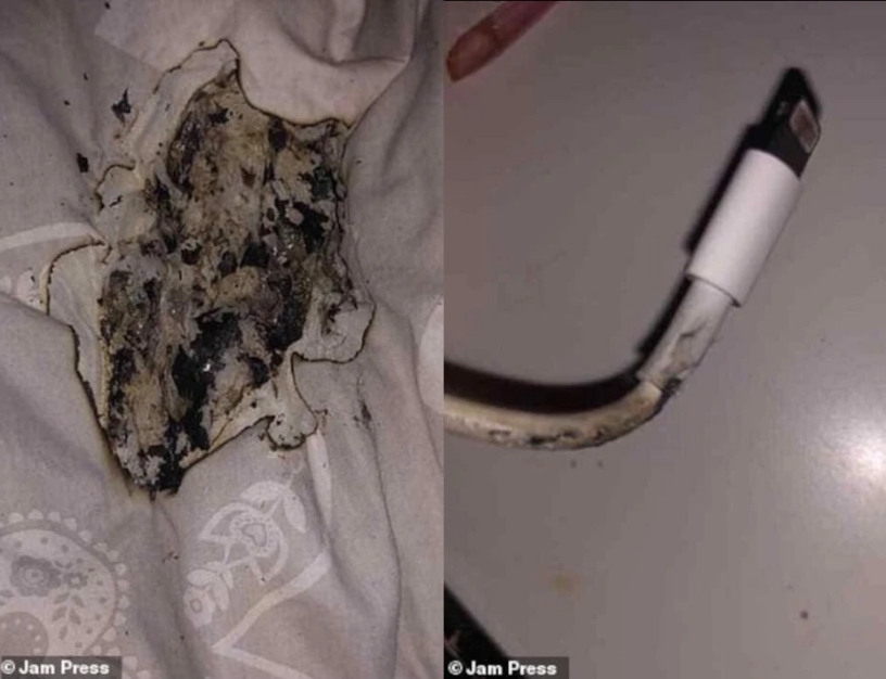 انفجار شارژر آیفون باعث سوختگی صورت دختر جوان شد