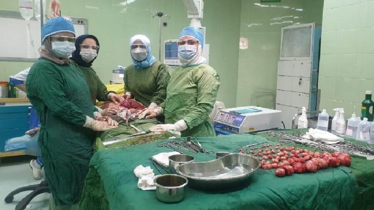 ۹۷ توده رحمی از شکم بانوی ۴۲ ساله تبریزی خارج شد