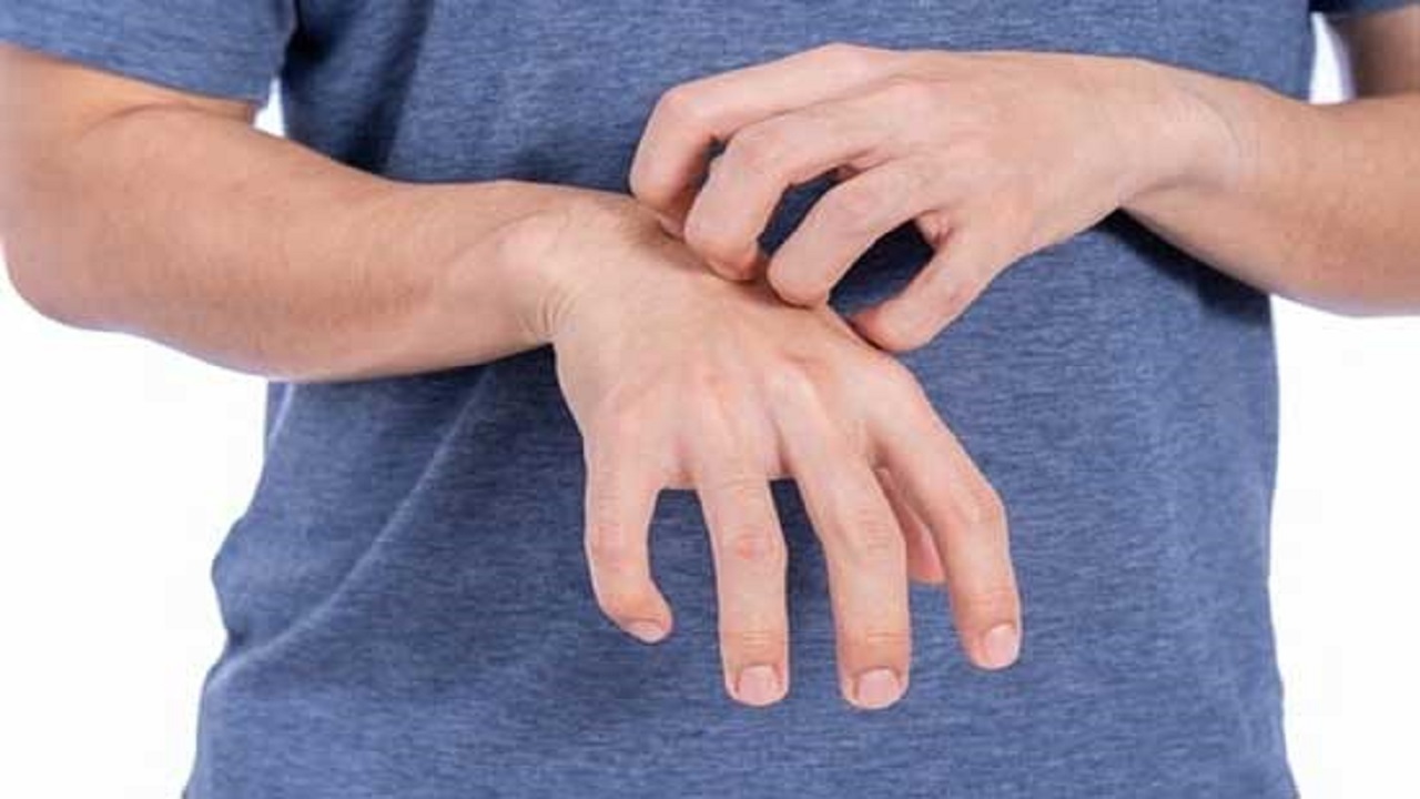 چه زمانی تغییرات پوستی خطرناک هستند؟