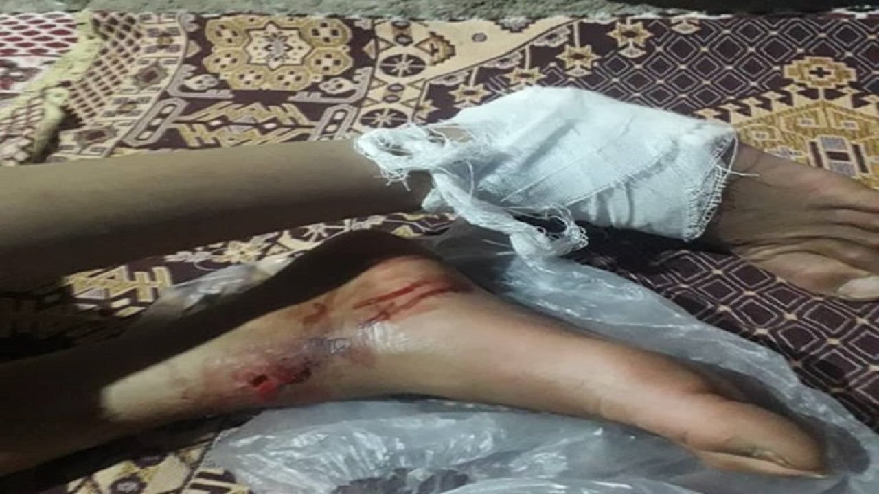 حمله شغال به چند نفر از اهالی ایرندگان
