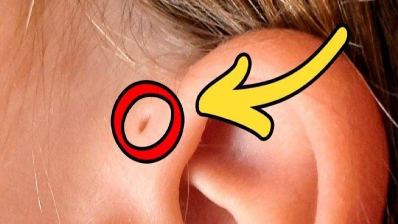 ویژگی های فیزیکی که تنها در بعضی افراد وجود دارد