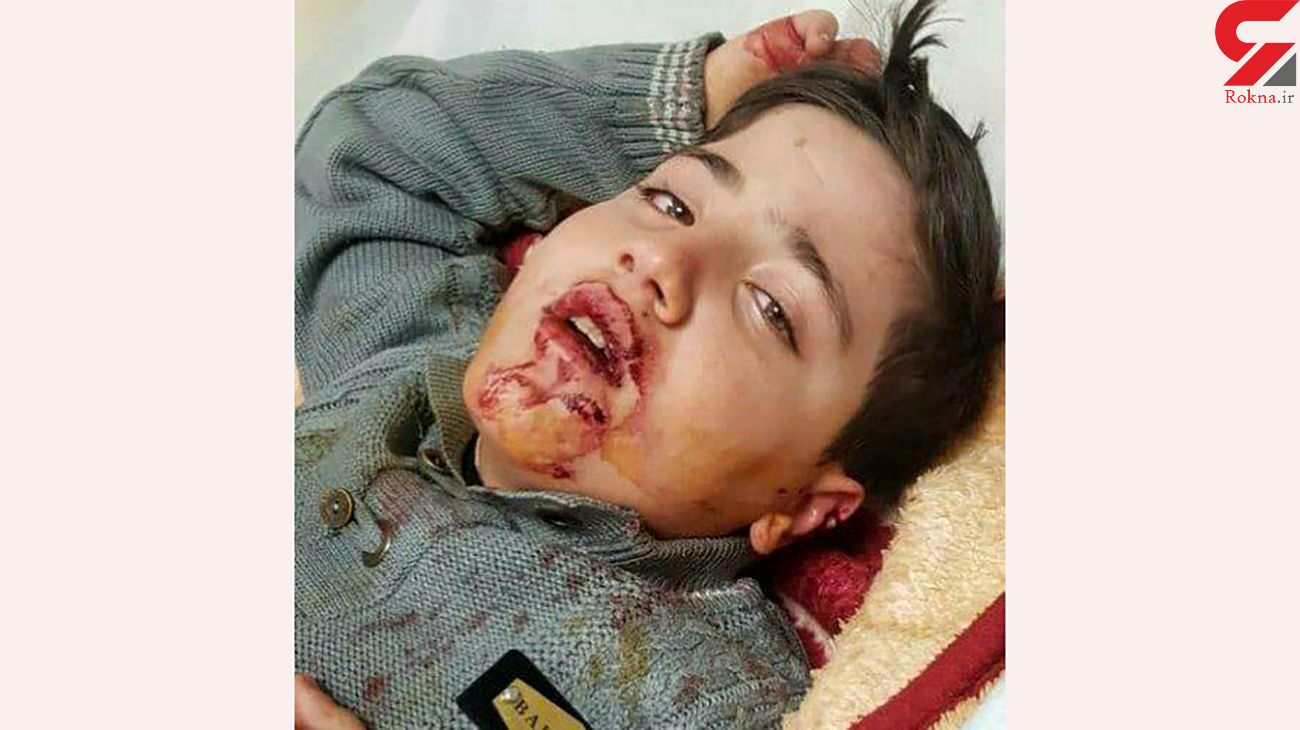 کودکان قربانی سگ ها