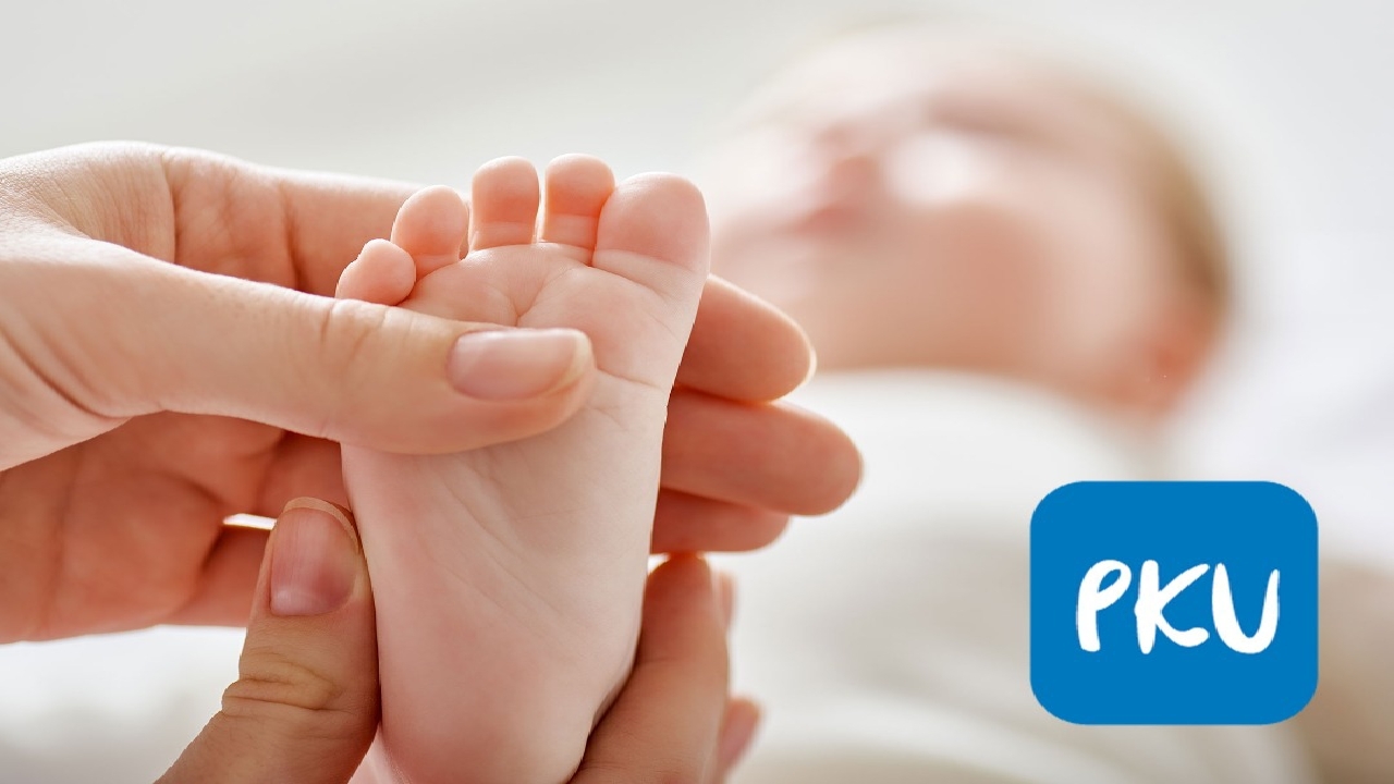 انجام آزمایش فنیل کتونوری برای نوزادان واجب است