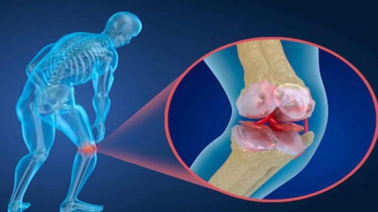 برای جلوگیری از پوکی استخوان در دوران کرونا چه کار کنیم؟