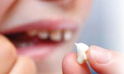 باشگاه خبرنگاران -اگر دندان آسیب دید چه کار کنیم؟