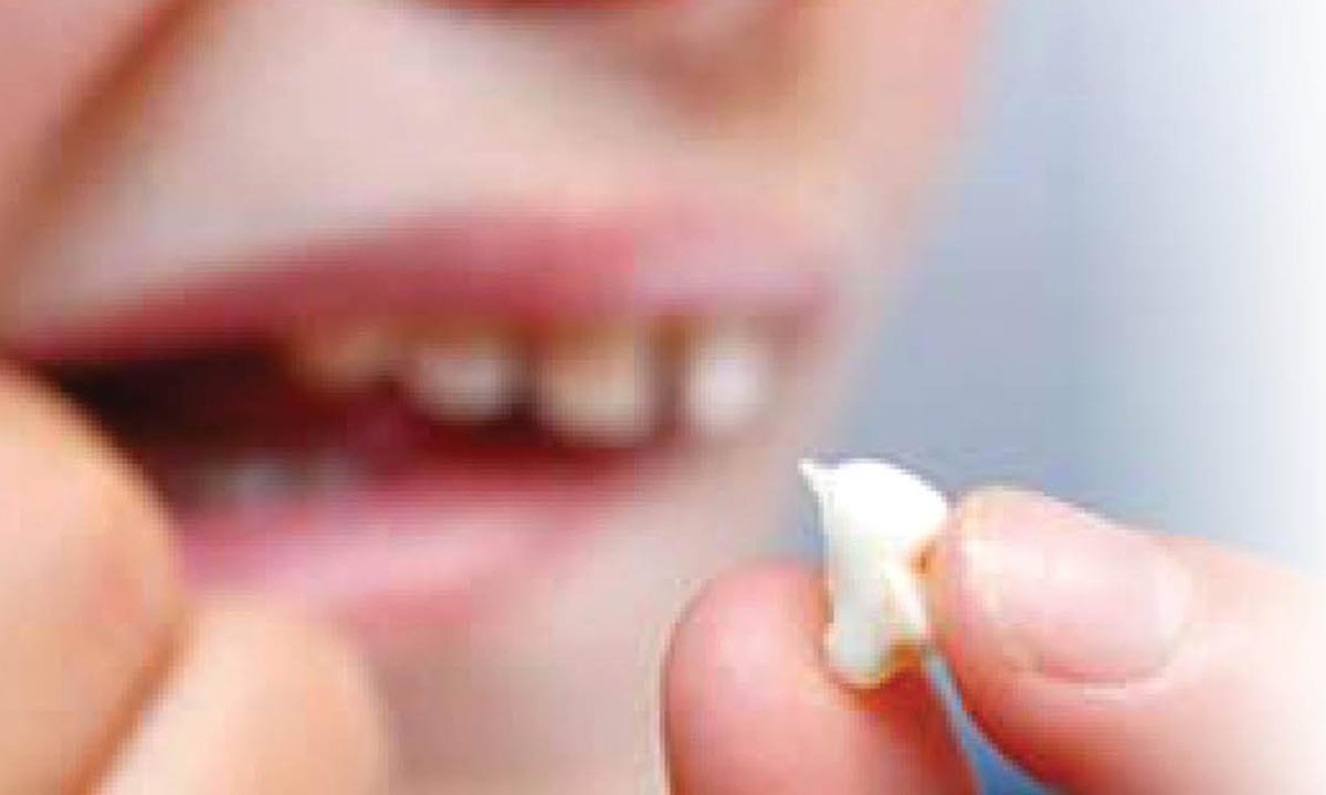 اگر دندان آسیب دید چه کار کنیم؟