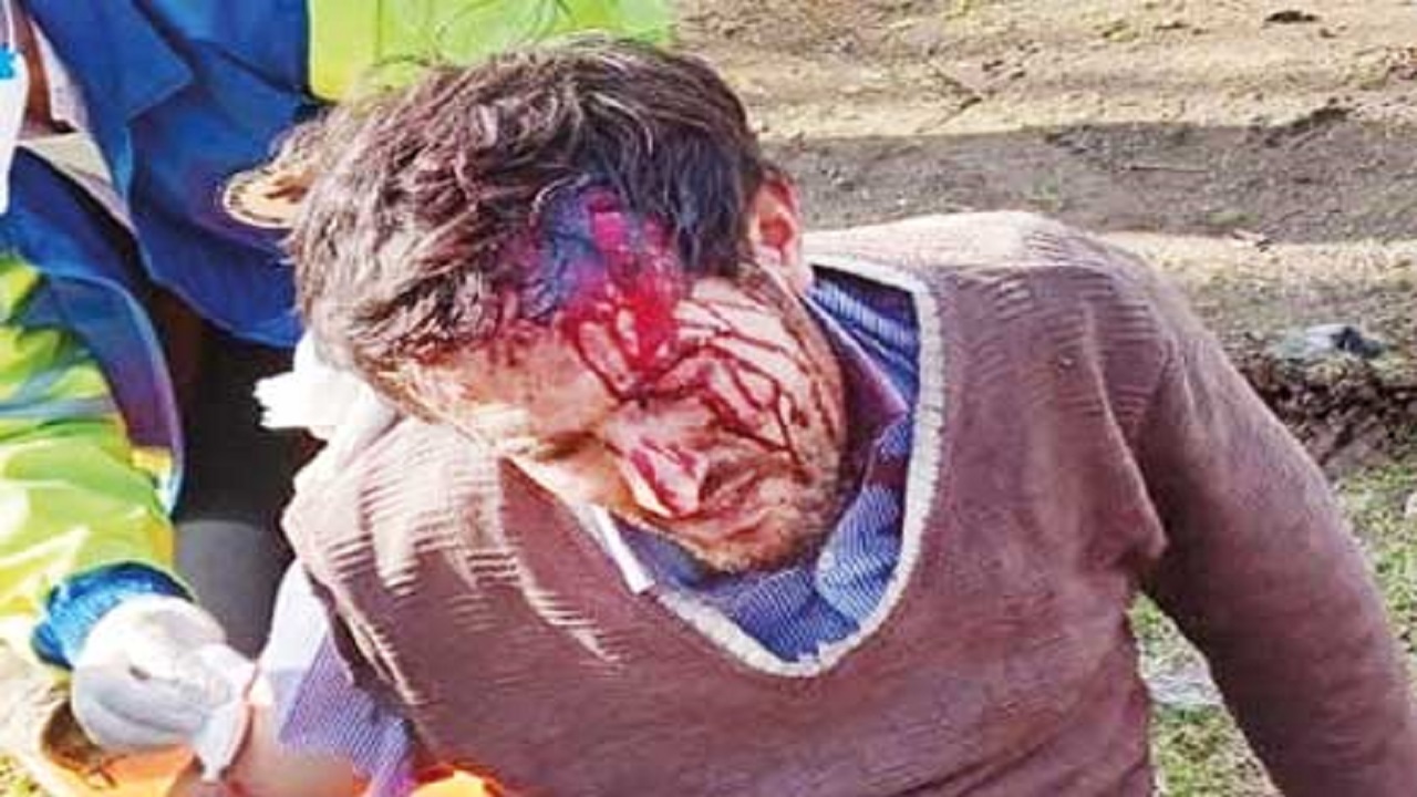 نجات معجزه آسای مرد چوپان از چنگال پلنگ