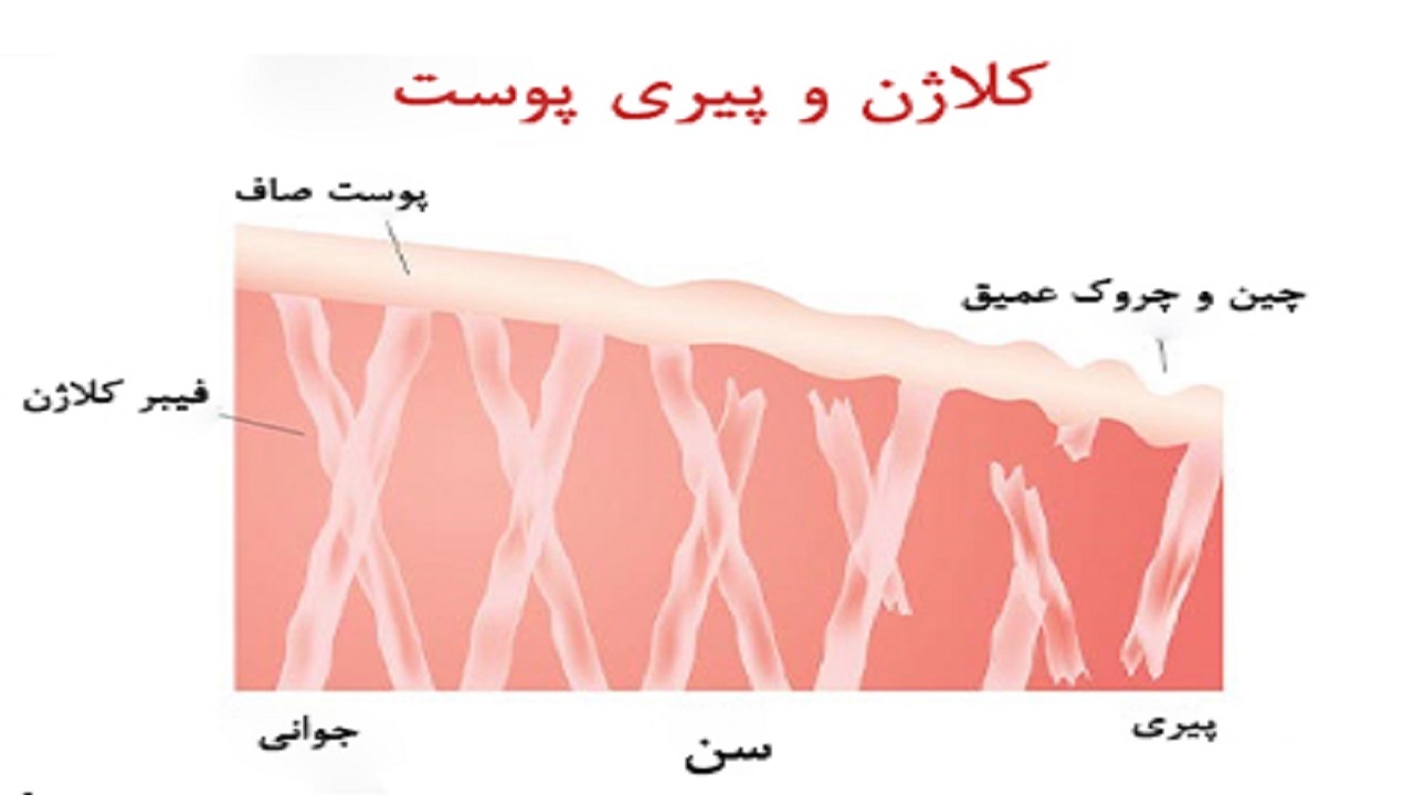 چه عواملی بر کاهش کلاژن بدن موثر است؟