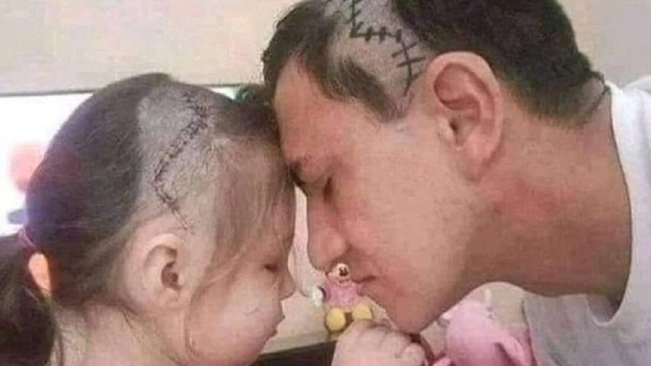 پدری که موهایش را به خاطر دختر بیمارش تراشید