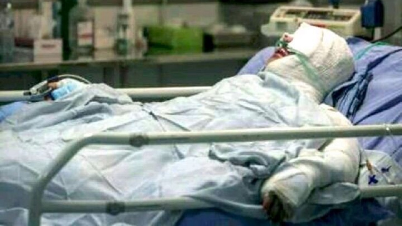 چهارمین انفجار مواد محترقه در استان مرکزی و نقص عضو ۲ نوجوان