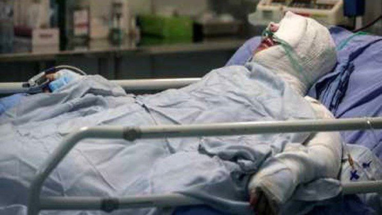 مصدوم شدن ۳۳ نفر بر اثر حوادث چهارشنبه آخر سال در قزوین