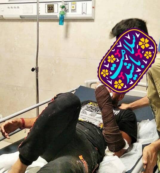 حوادث چهارشنبه سوری در هرمزگان سه مصدوم داشت