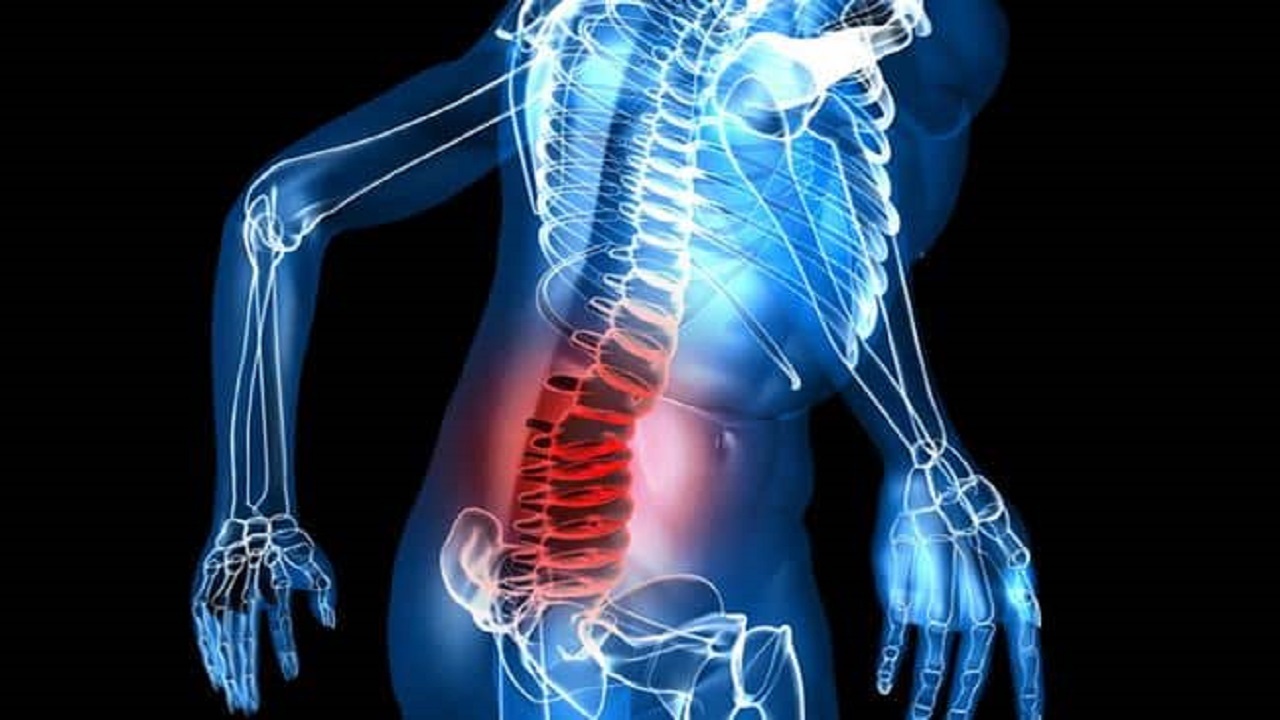 آرتروز در مفاصل بزرگتر بدن ایجاد می‌شود