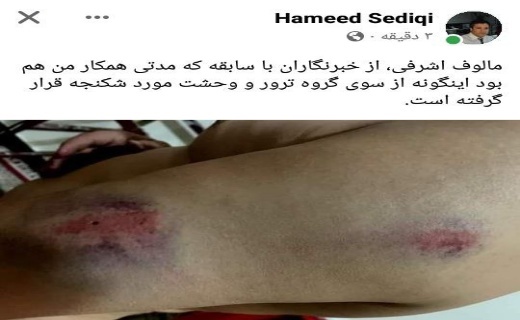 طالبان خبرنگار افغانستانی را لت و کوب کردند