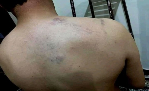 طالبان خبرنگار افغانستانی را لت و کوب کردند