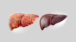 تسکین سرفه با این دمنوش گیاهی + فیلم