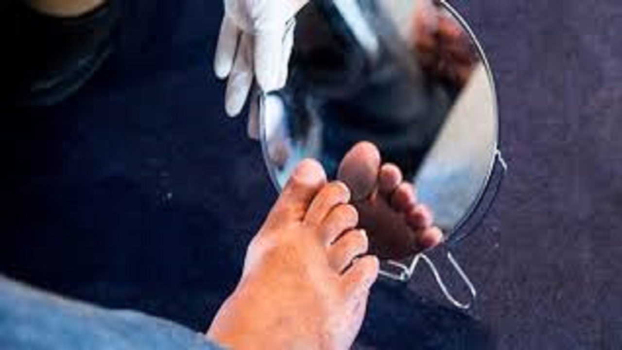 چگونه سلامت پاهایمان را به هنگام دیابت مدیریت کنیم؟