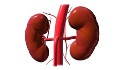 فیلمی از لحظه تشکیل سنگ کلیه