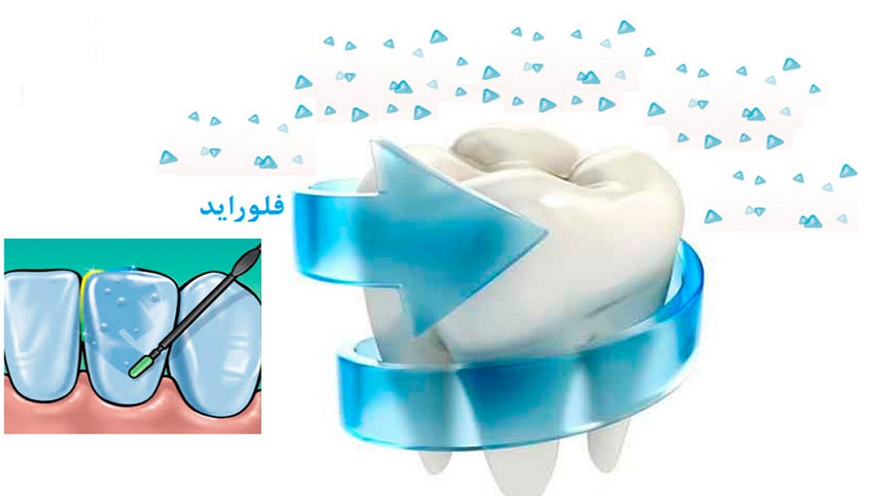 اجرای طرح بهداشت دندان برای ۳۷ درصد از کودکان خراسان رضوی