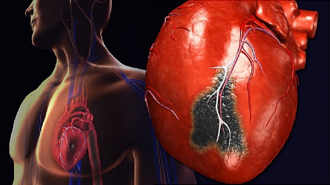 چگونه حمله قلبی را از سوء هاضمه و آنژین قلبی تشخیص دهیم؟