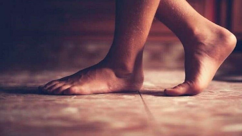 سه علامت در پا&zwnj;ها که نشانه کب چرب هستند