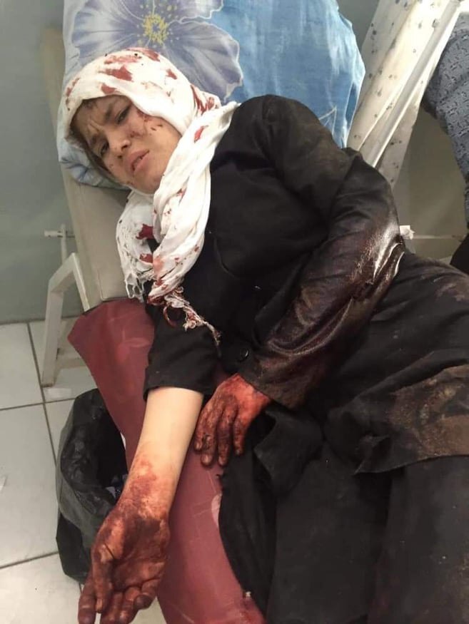 ۸۲ کشته و زخمی در انفجار افغانستان 04