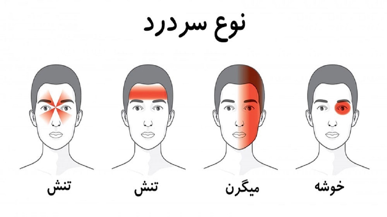 سردرد