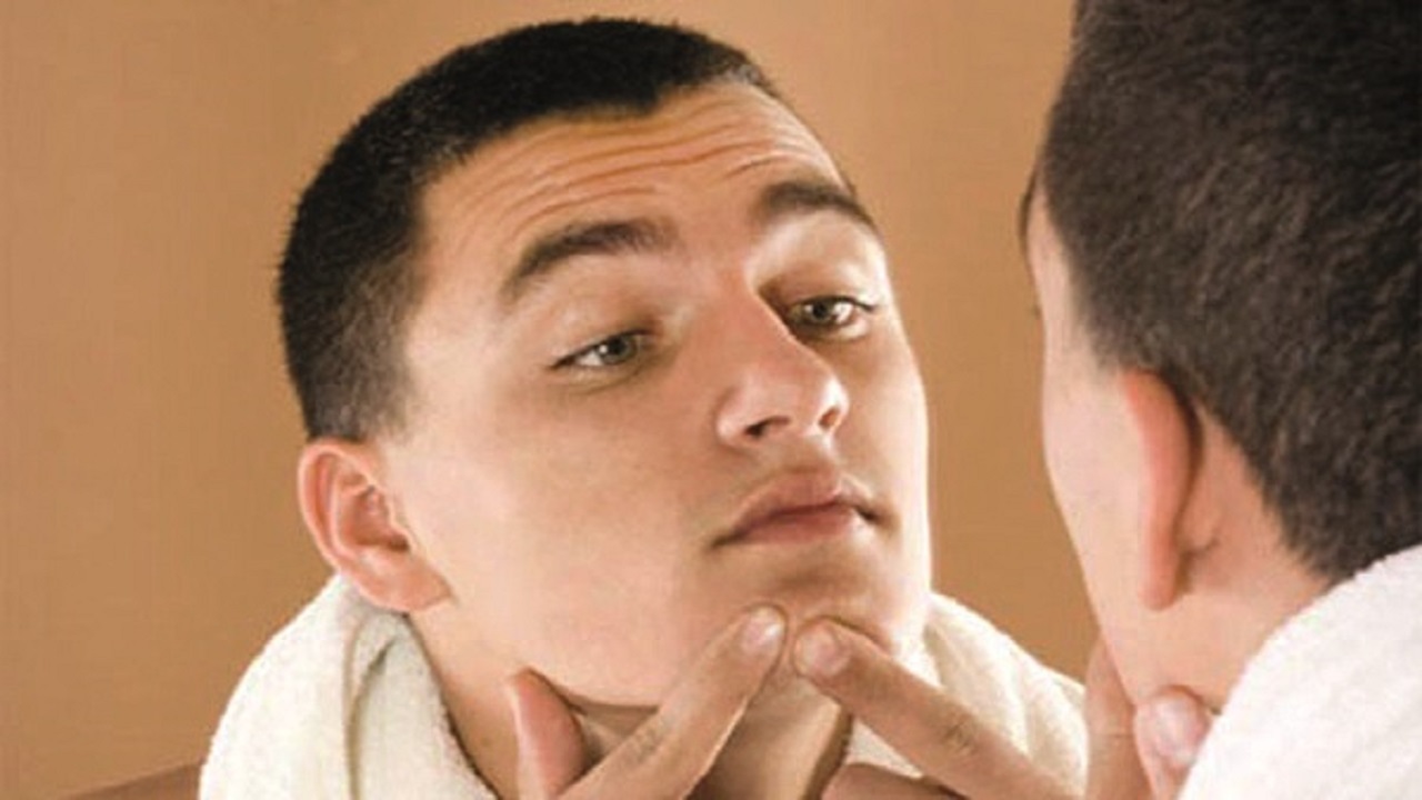 قصه جوش و دمل‌های بهاری