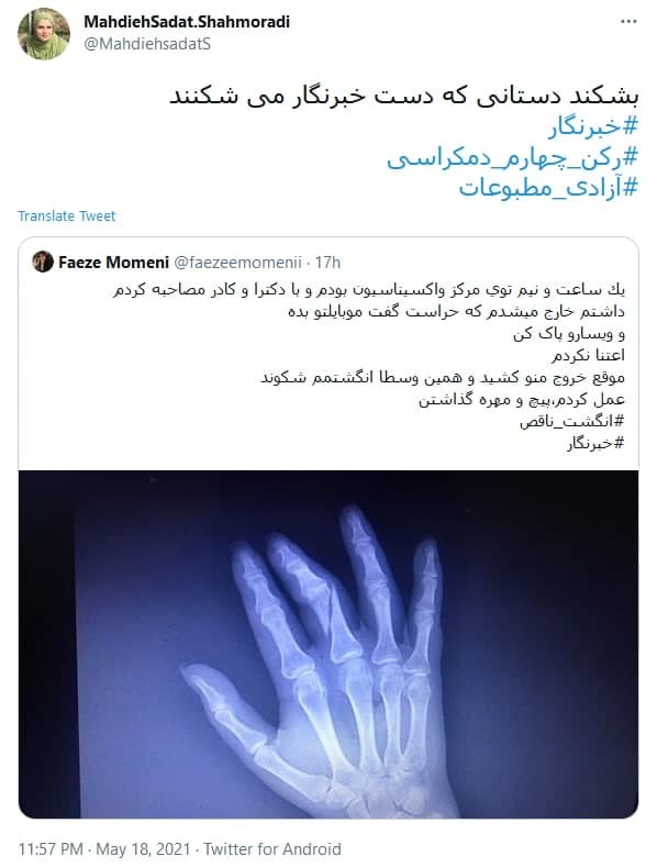 واکنش کاربران به شکستن دست خبرنگار زن