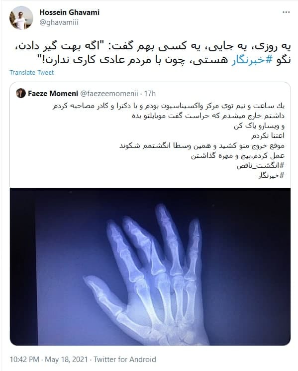 واکنش کاربران به شکستن دست خبرنگار زن